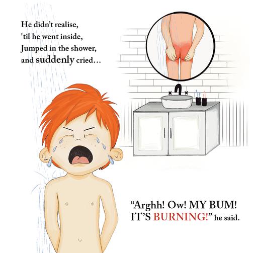 The Adventures of Willy and his Sunburnt Bum!