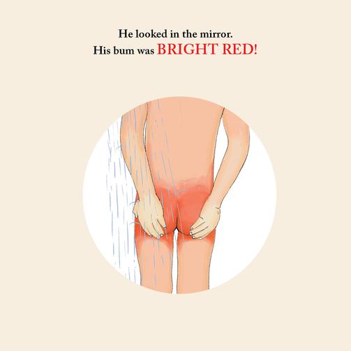 The Adventures of Willy and his Sunburnt Bum!